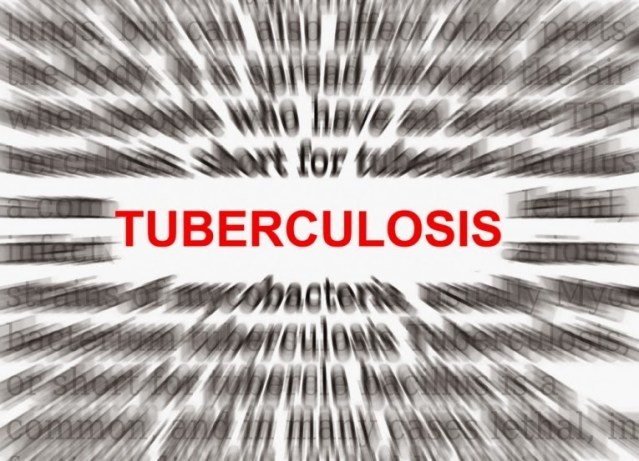 Tuberculosis Causes, Symptoms, Diagnosis, Treatment, Prevention (2)